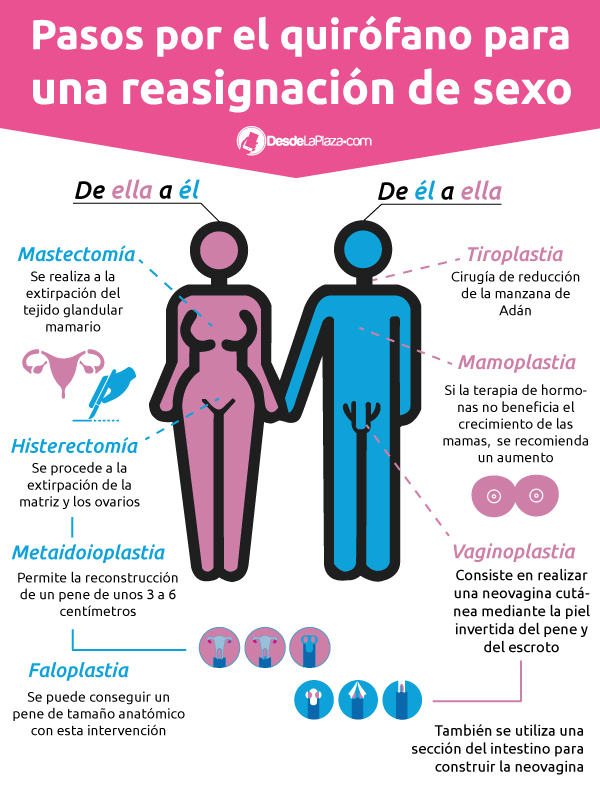 infografía-cambio-de-sexo (1)