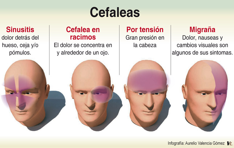 cefaleas