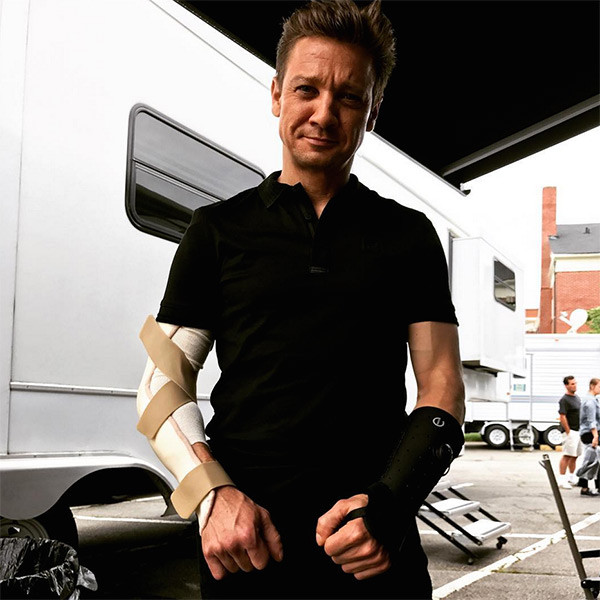 renner fracturado