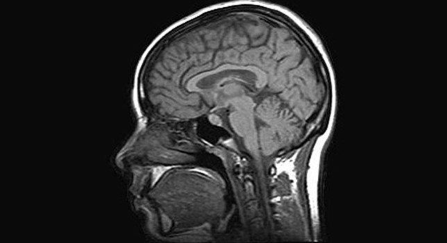 Cerebro: Escaner