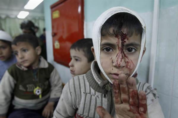 Gaza: niño herido