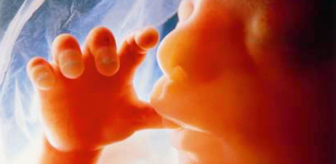 Foto de feto aun en vientre materno