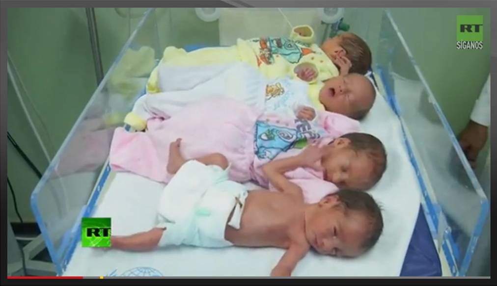 Nacen cuatrillizos en medio de la operación israelí contra Gaza